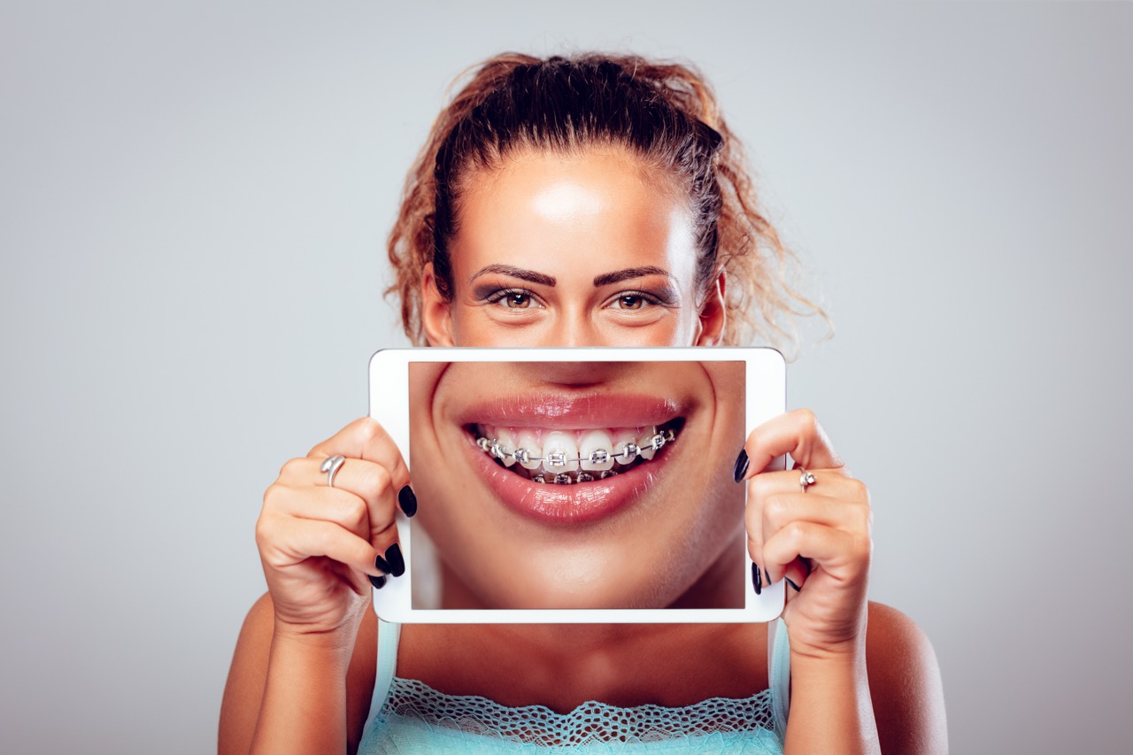 Braces & Aligners illustration 2