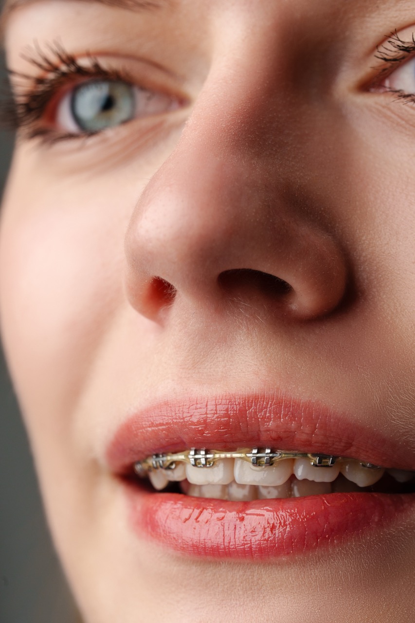 Braces & Aligners illustration 3