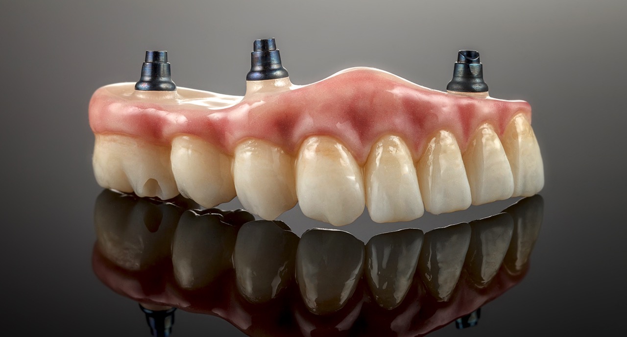 Crowns & Dentures