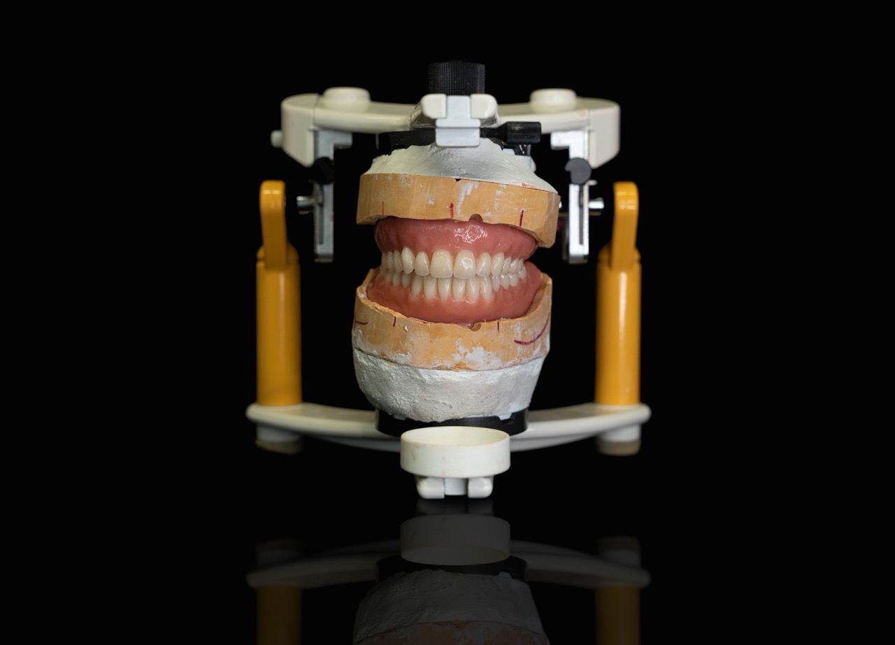 Gum Surgery & Periodontics