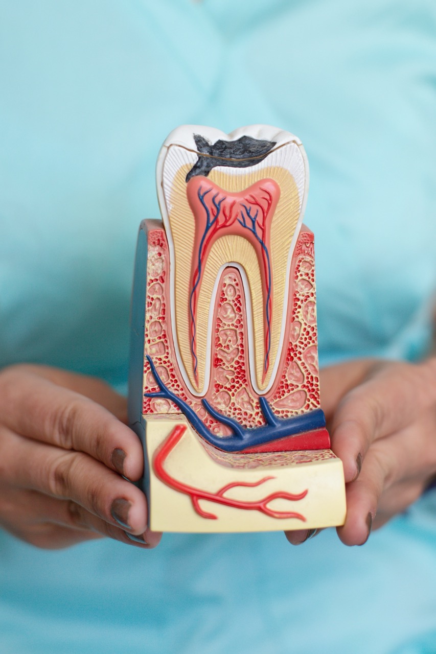 LASER Dentistry