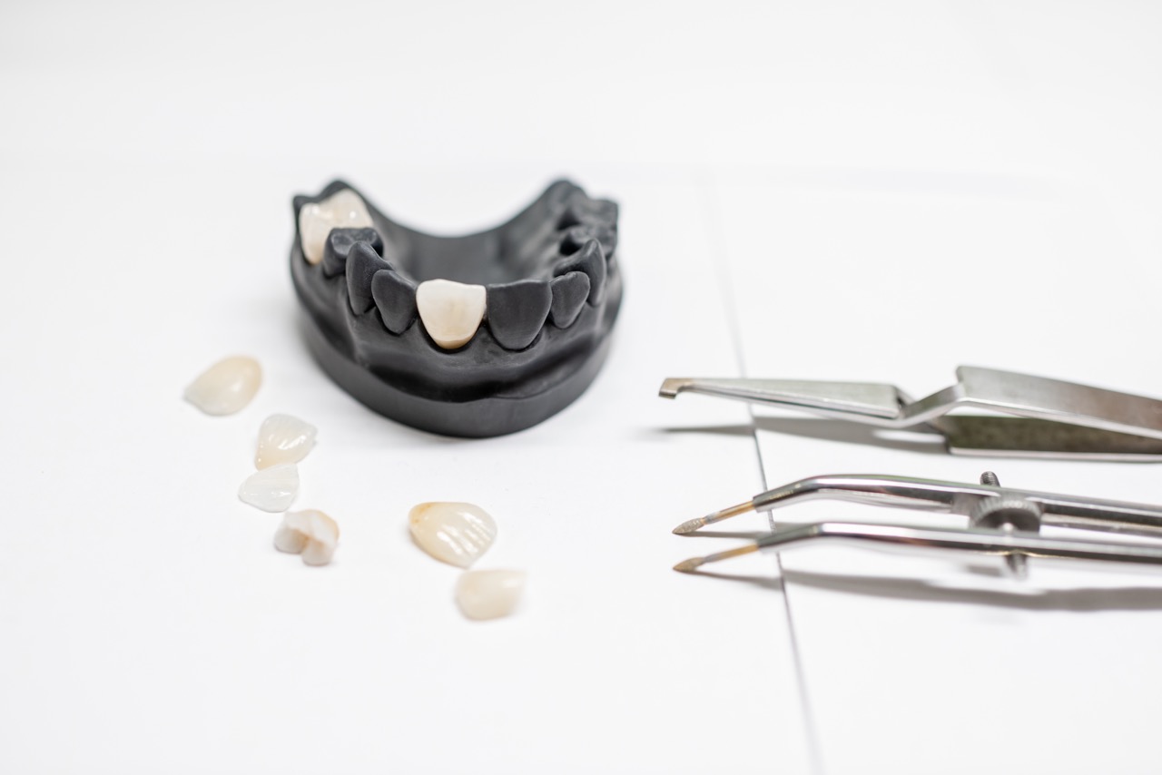 Smile Designing